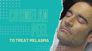 Cosmelan Peel to Treat Melasma  Dr Jason Emer [upl. by Nwadrebma]