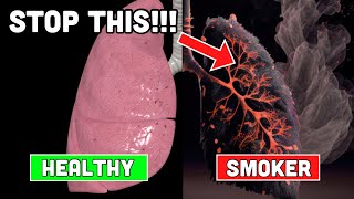 Doctor Explains How to PURIFY Smokers Lungs [upl. by Hescock]