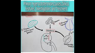 Primary HyperaldosteronismCausesClinical Features Investigations and Treatment [upl. by Dduj810]