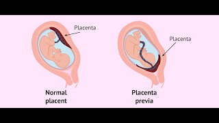 Placenta development part 1general embryologyشرح بالعربي [upl. by Oicangi]