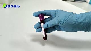 Portable Glycosylated Hemoglobin Analyzer UD H100  Operation Video  Best Lab [upl. by Nnaylrebmik]