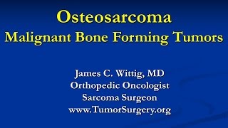 Orthopedic Oncology Course  Malignant Bone Forming Tumors Osteosarcoma  Lecture 4 [upl. by Euqirne]