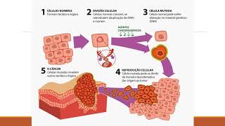 Displasia e Neoplasia [upl. by Inhsor724]