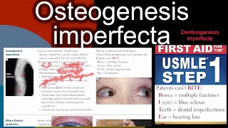 Osteogenesis imperfecta  Dentinogenesis imperfecta in HindiUrdu by first aid for USMLE step 1 [upl. by Naitsabas680]