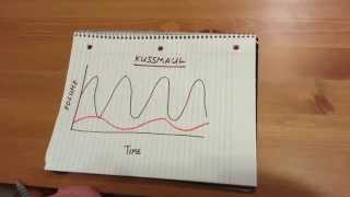 Kussmaul Respiration [upl. by Yllom]