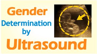 Gender Determination by Ultrasound [upl. by Nitsirc]