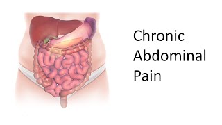 An Approach to Chronic Abdominal Pain [upl. by Elleynod403]