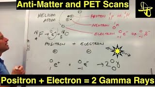 Medical Physics PET Scans Positron Emission Tomography Positron Annihilation and Antimatter [upl. by Cigam]