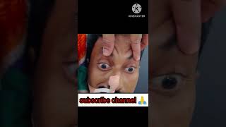 Abnormal Doll’s Eye  Oculocephalic Reflex  hospital eyediseases india mp shorts shortvideo [upl. by Gabriella]