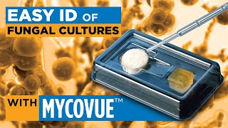 MycoVue™ slide culture for easy identification of fungi [upl. by Hecht]