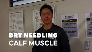 Calf muscle dry needling demonstration [upl. by Thaddaus]