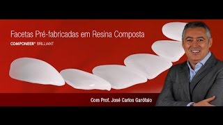 Vídeoaula Facetas Pré Fabricadas em Resina Composta com Prof José Carlos Garófalo [upl. by Eniamreg718]