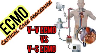 ECMO VV VS VA ECMO [upl. by Moynahan657]