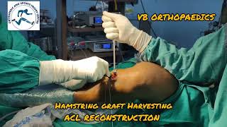 HAMSTRING GRAFT HARVESTING ACL RECONSTRUCTION WITH Hamstring graft How to Harvest ACL Graft [upl. by Dorothy]