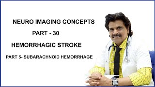 NEUROIMAGING CONCEPTS PART  30HEMORRHAGIC STROKEPART 5 SUBARACHNOID HEMORRHAGE [upl. by Elexa]