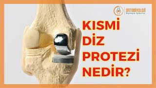 KISMİ  YARIM  DİZ PROTEZİ TEDAVİSİ NEDİR [upl. by Glasgo]