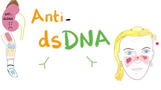 Antidouble Stranded DNA AntidsDNA Antibodies  Systemic Lupus Erythematosus SLE [upl. by Nauqyt215]