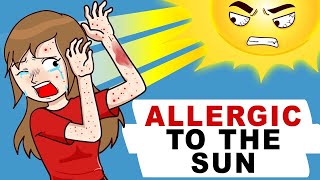 I Am Allergic To The Sun [upl. by Aes]