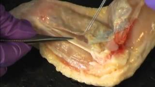 Chicken Wing Dissection Activity [upl. by Odelle]