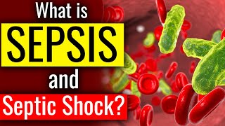 What is SEPSIS and SEPTIC SHOCK  The Bodys Deadly response to Infection Sepsis  Cause Symptom [upl. by Fahy]