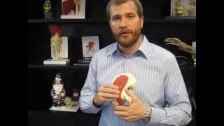 Psoas Muscle Injury [upl. by Elah]