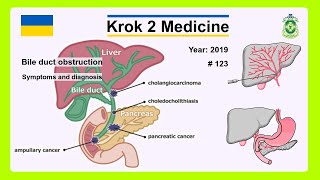 Krok 2 Medicine  Year 2019  123 Ministry of Public Health of Ukraine [upl. by Heinrik]