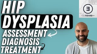 Do You Have HIP DYSPLASIA Heres What You Need to Know [upl. by Giltzow]