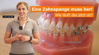 Die ersten Schritte zur Zahnspange  KieferStellwerk  Dr Lisa Tack [upl. by Wash705]