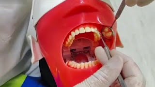 Scaling Teeth Manual amp Type Of Rest شرح بالتفصيل [upl. by Yelram]