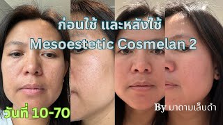 รีวิว Mesoestetic Cosmelan 2 [upl. by Uis95]