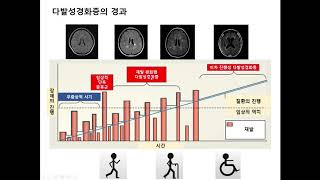 다발성경화증의 치료 1 [upl. by Battista300]