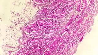 Exploración microscópica de un esófago con Sarcocystis sp [upl. by Bashemeth349]