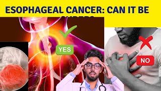 What is the survival rate for esophageal cancer [upl. by Ettennej]