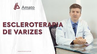 Aplicação e Escleroterapia de Varizes [upl. by Winou]