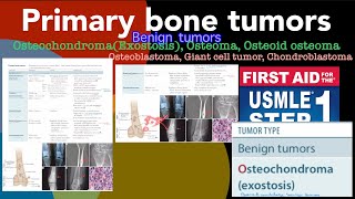 Primary bone tumors Benign tumors Osteochondroma Osteoma Osteoid osteoma Giant cell tumor etc [upl. by Sigfrid421]