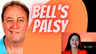 Understanding Bells Palsy How Physical Therapy can treat facial paralysis  Doc Cherry [upl. by Michal]