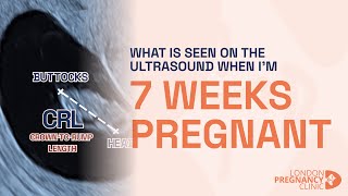 Week 7 Pregnant Ultrasound Babys Heartbeat amp Growth Shown [upl. by Alva]