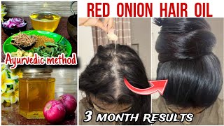 3 MONTH HAIR GROWTH CHALLENGE WITH ONION HAIR OIL 🧅 how to prepare herbal hair oil at home 🏠 [upl. by Atalie615]