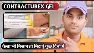 Contractubex gel uses dose benefits and side effects full review in hindi [upl. by Notsehc]