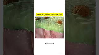 saline irrigation in nasal Allergies anatomy 3Dstructure biology pharmacy shorts viral nasal [upl. by Glarum223]