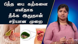 பித்தப்பை கற்களுக்கு எளிய தீர்வு  Gall Bladder Stone  Cholelithiasis  DrB Yoga vidhya [upl. by Siol]