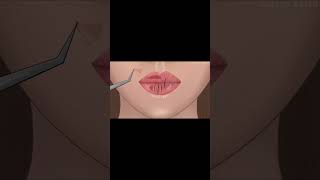 lipcare ASMR animation chapped lips treatment catchy ASMR asmranimation asmrvideo animation [upl. by Aseeral]