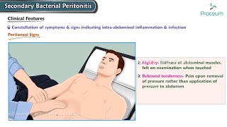 Secondary Bacterial Peritonitis Etiology Clinical features Diagnosis Management Surgery [upl. by Enorel]