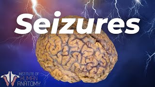 Whats Actually Happening During a Seizure [upl. by Yrffoeg]