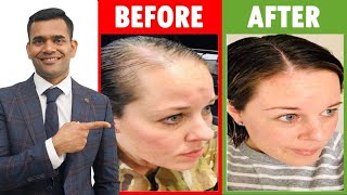 3 Home Remedies To Prevent Hair loss And Regrow Your Hair [upl. by Noval485]