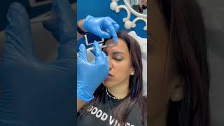 Preventative Botox At Beverly Hills Wellness Center amp Med Spa Florida shorts [upl. by Anirtap207]