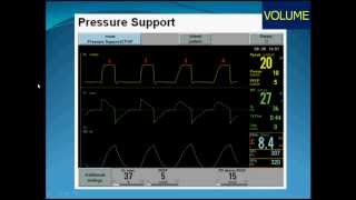 Mechanical ventilation14Expiratory sensitivityEnglish [upl. by Rauch]