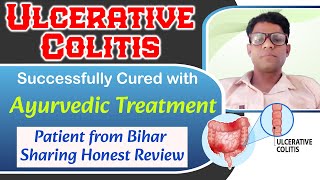 Ulcerative Colitis Ayurvedic Treatment Successfully Cured Patient From Bihar Sharing Honest Review [upl. by Faus]