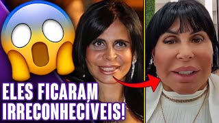 FAMOSOS QUE FIZERAM HARMONIZAÇÃO FACIAL E FICARAM MUITO DIFERENTES  Virou Festa [upl. by Ydal404]