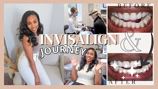 INVISALIGN JOURNEY START TO FINISH  WHAT TO EXPECT WITH INVISALIGN  LoveLexyNicole [upl. by Robins]